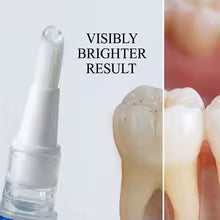 Teeth Whitening Pen Gel