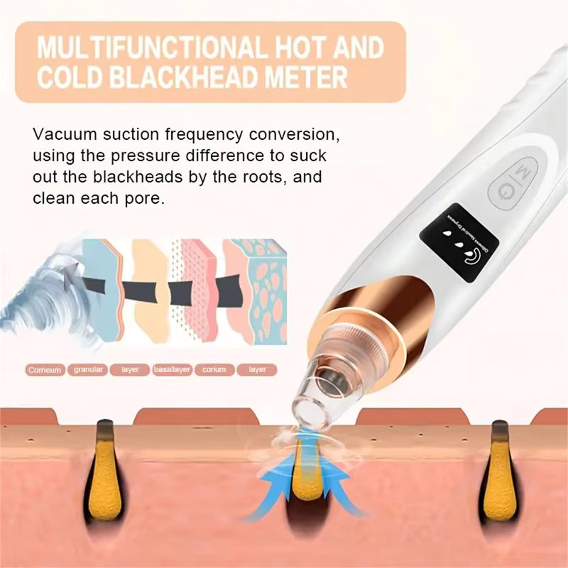 Blackhead Remover Vacuum Pore Cleaner